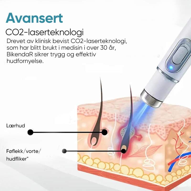 Sporløs Fregnefjerning Laser Føflekkfjerning Skjønnhetsinstrument