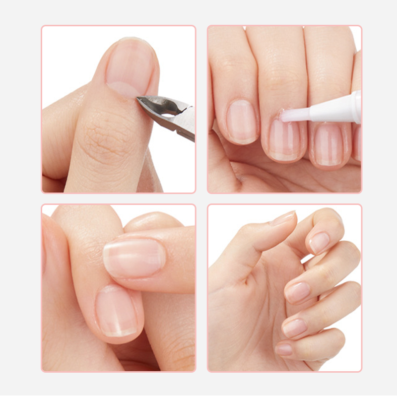 Neglebånd Næringspenn