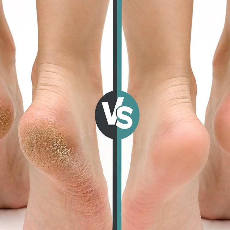 Oppladbar elektrisk pedikyrverktøy