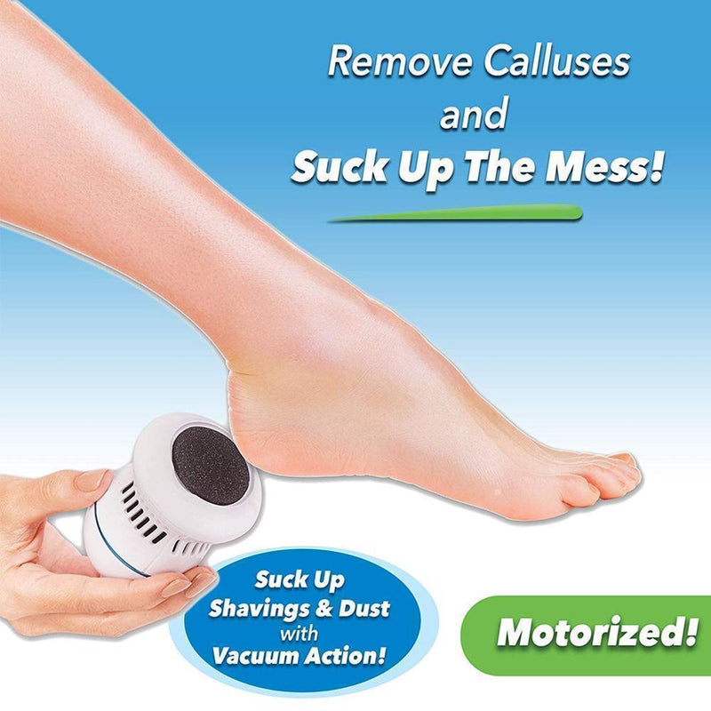 Hirundo Foot File and Callus Remover - mygeniusgift