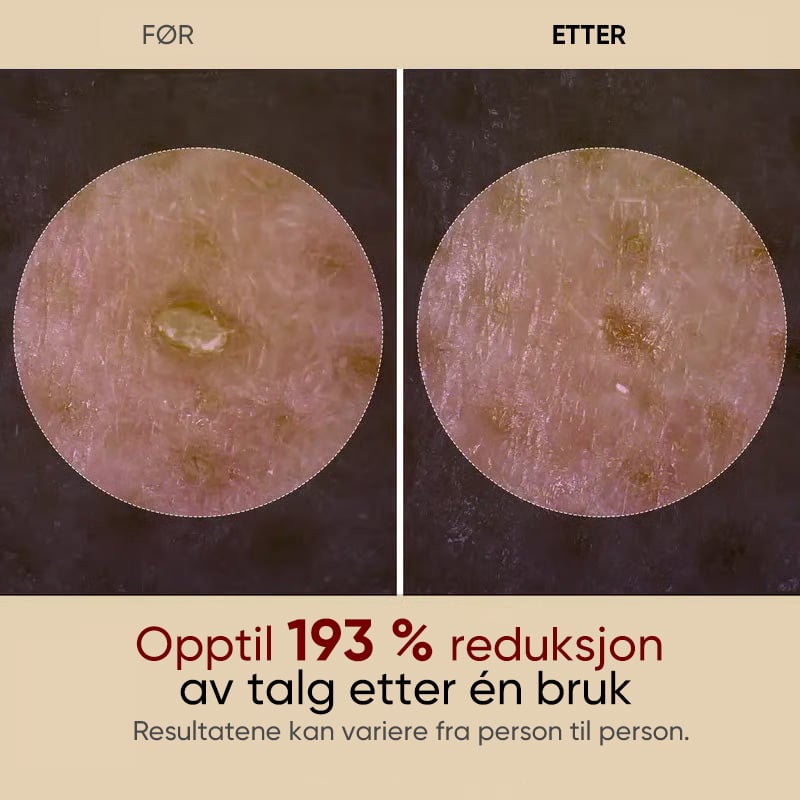 Skånsom Eksfolierende Ampulle