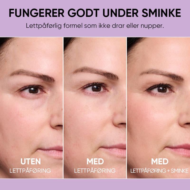 Midlertidig Øyestrammer