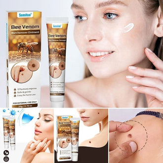 🌿 Krem mot vorter/hudfliker 🩹