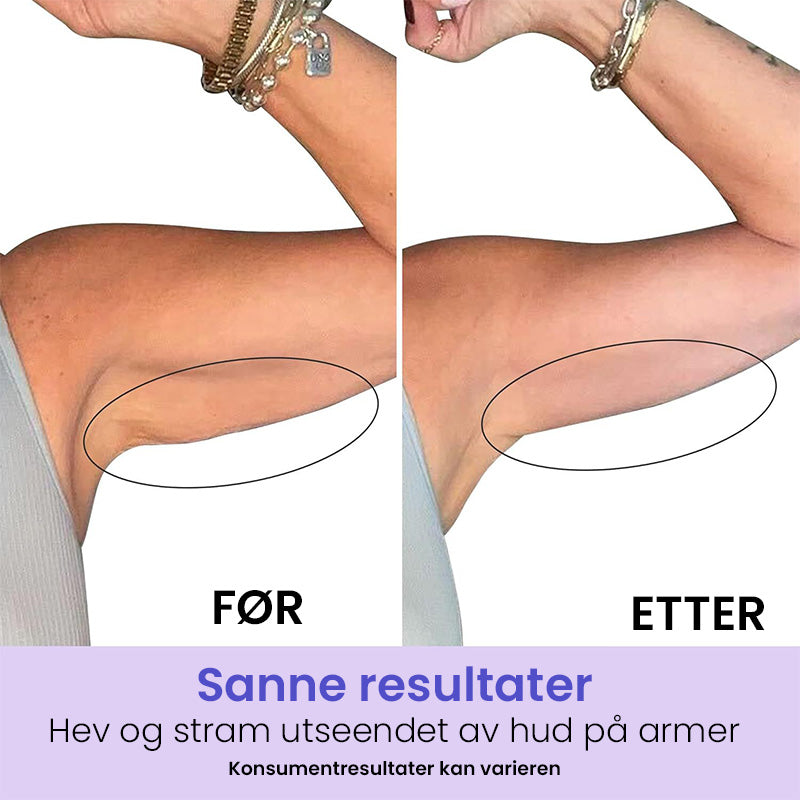 Formende Armkrem