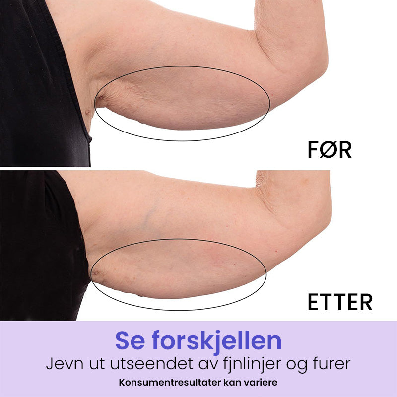 Formende Armkrem