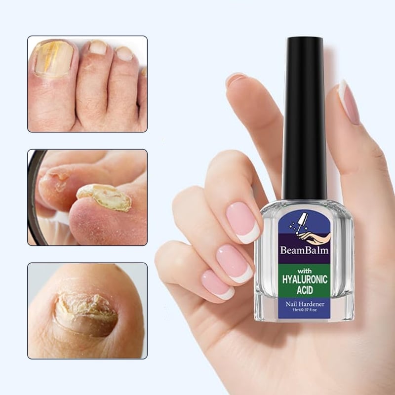 Soppdrepende neglereparasjonsløsning