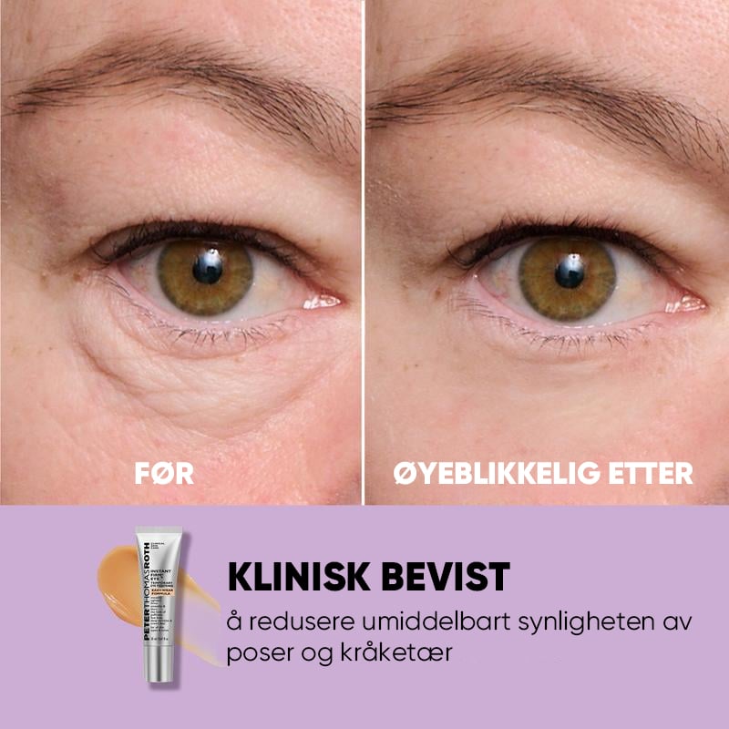 Midlertidig Øyestrammer