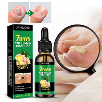 Ingefær Negle Behandling