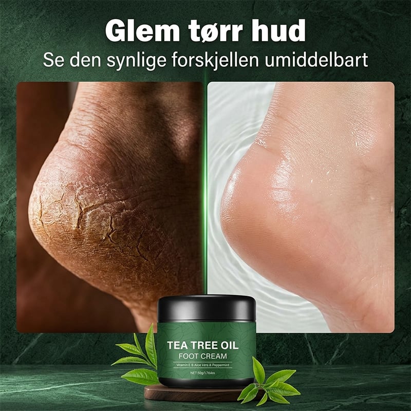 Tea Tree Olje Fotkrem