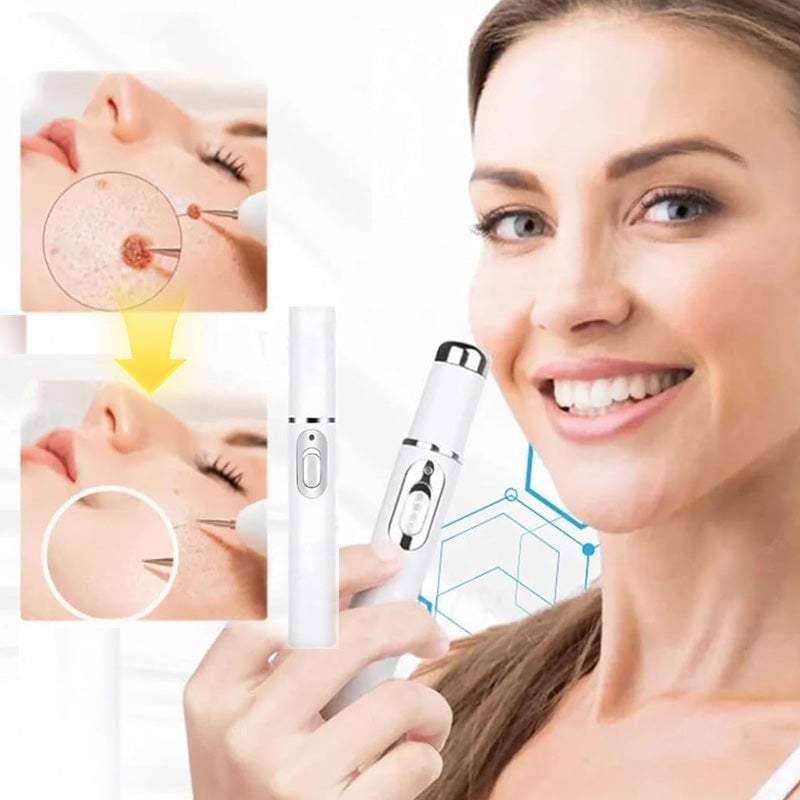 Sporløs Fregnefjerning Laser Føflekkfjerning Skjønnhetsinstrument