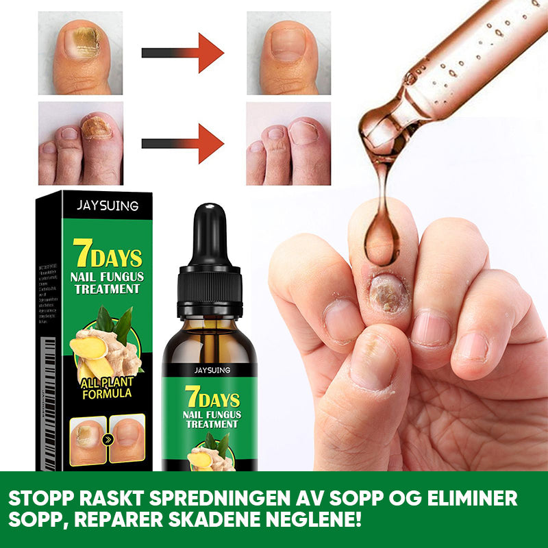 Ingefær Negle Behandling