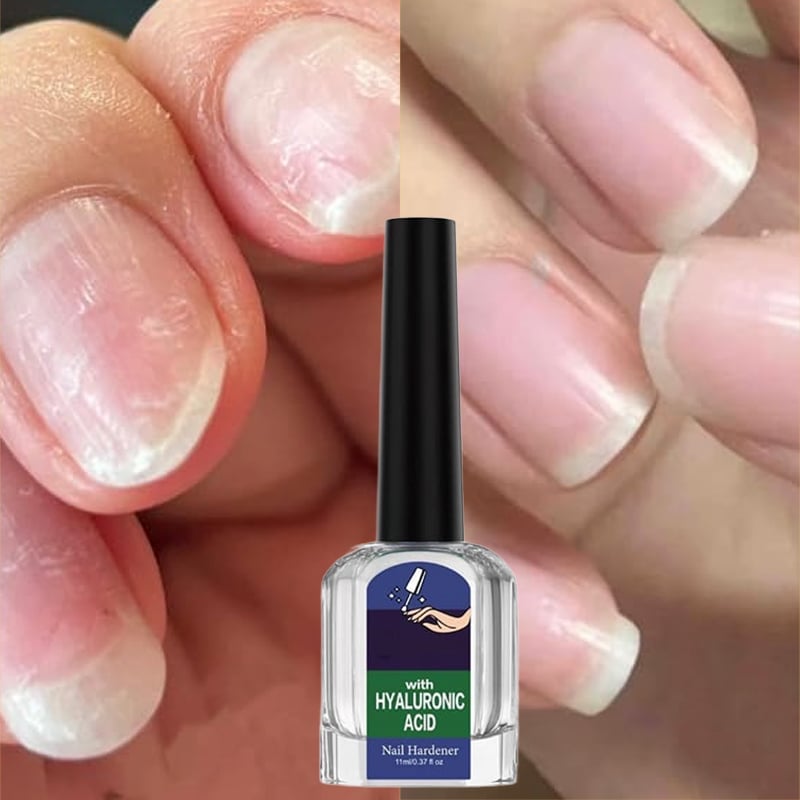 Soppdrepende neglereparasjonsløsning