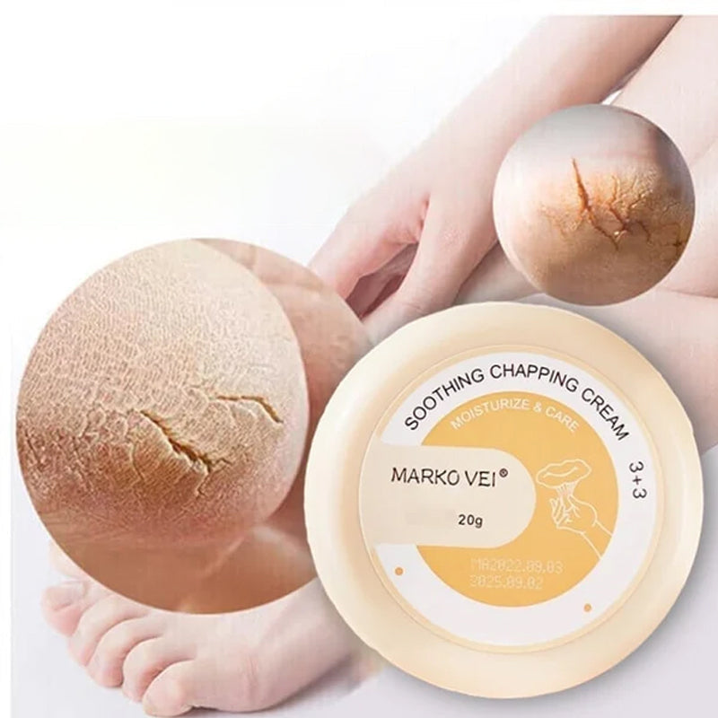 Vinter Anti-Cracking Cream
