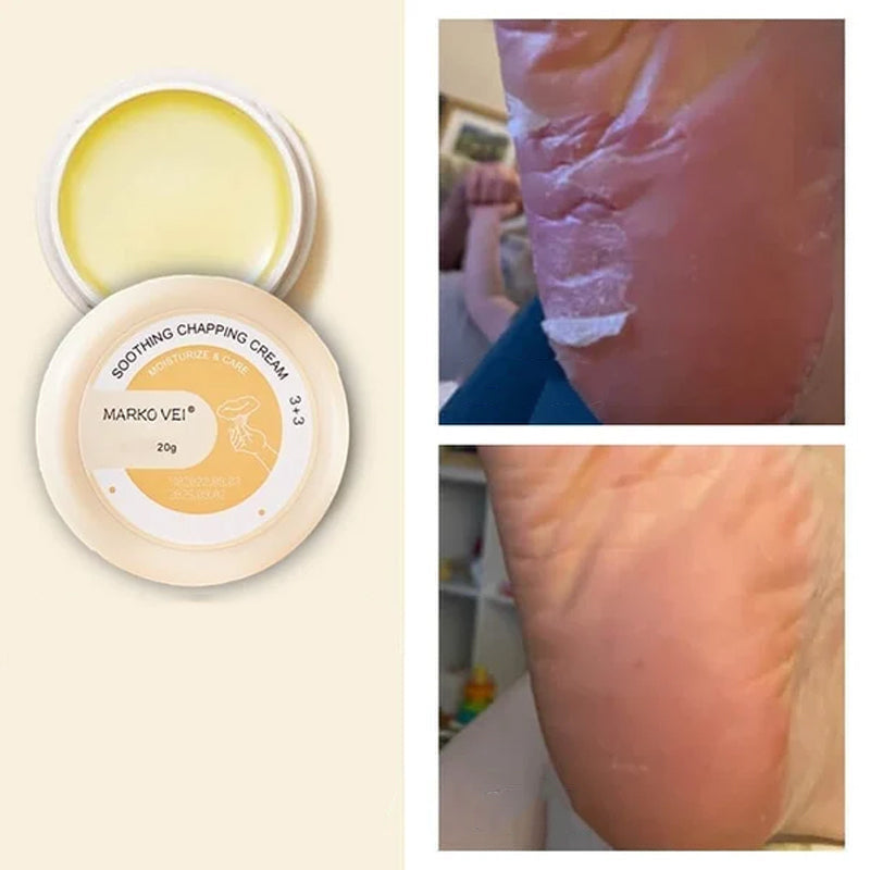 Vinter Anti-Cracking Cream