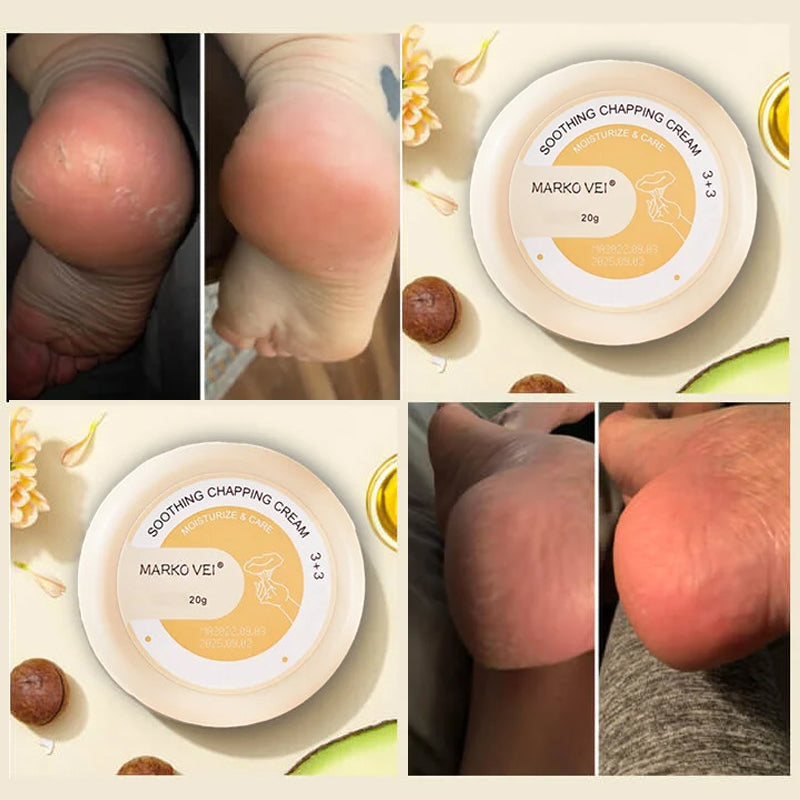Vinter Anti-Cracking Cream