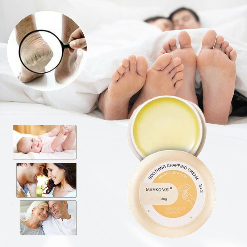 Vinter Anti-Cracking Cream