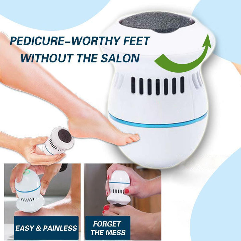 Hirundo Foot File and Callus Remover - mygeniusgift