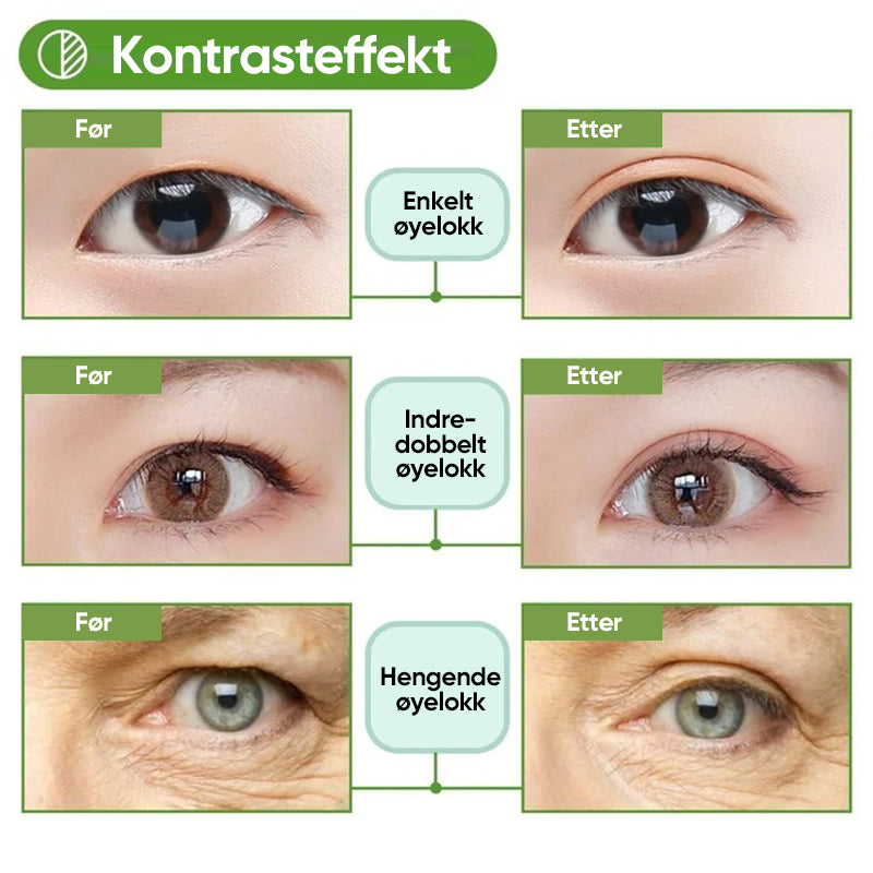 Sett med usynlige øyelokkstrimler